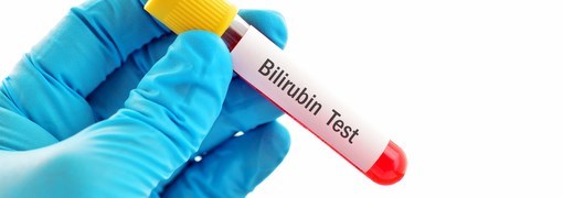 בדיקת רמות בילירובין בדם (Bilirubin) - תמונה